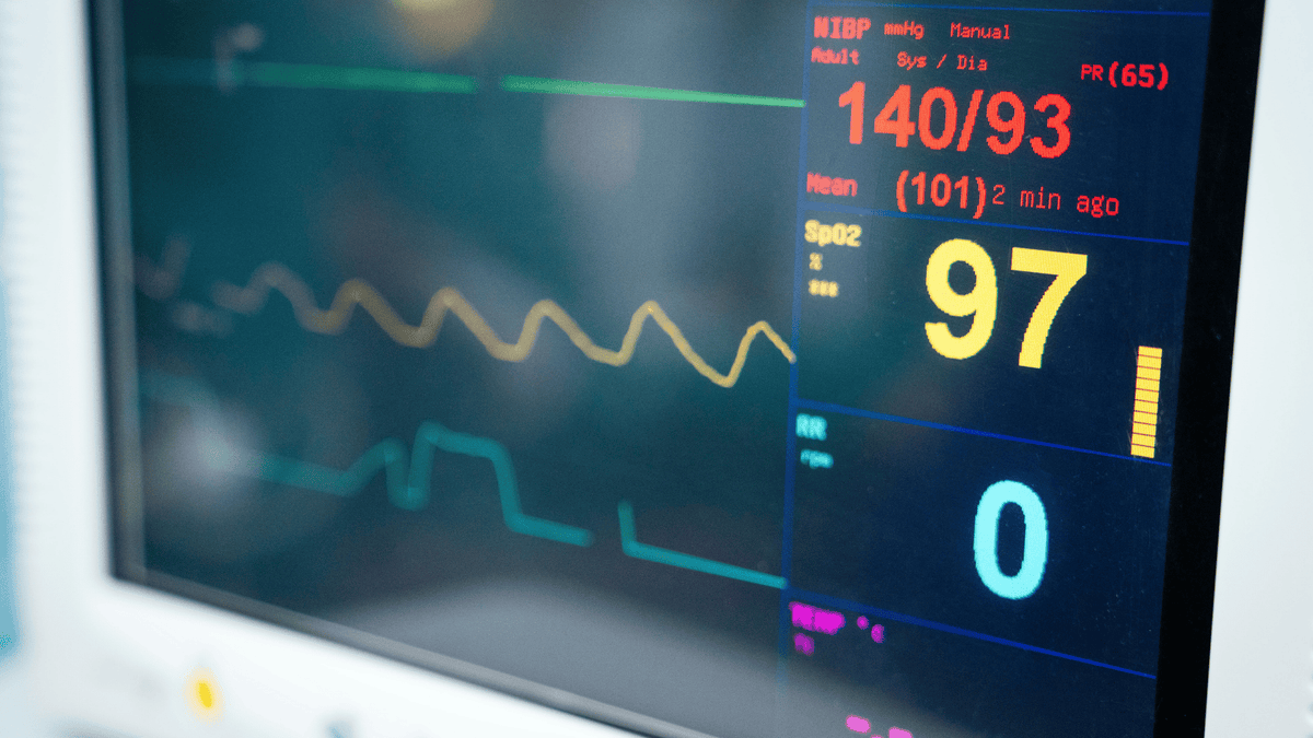 Eine ärztliche Abklärung mittels EKG oder Langzeit-EKG kann zuverlässig unterscheiden, ob eine harmlose oder eine behandlungsbedürftige Ursache vorliegt.