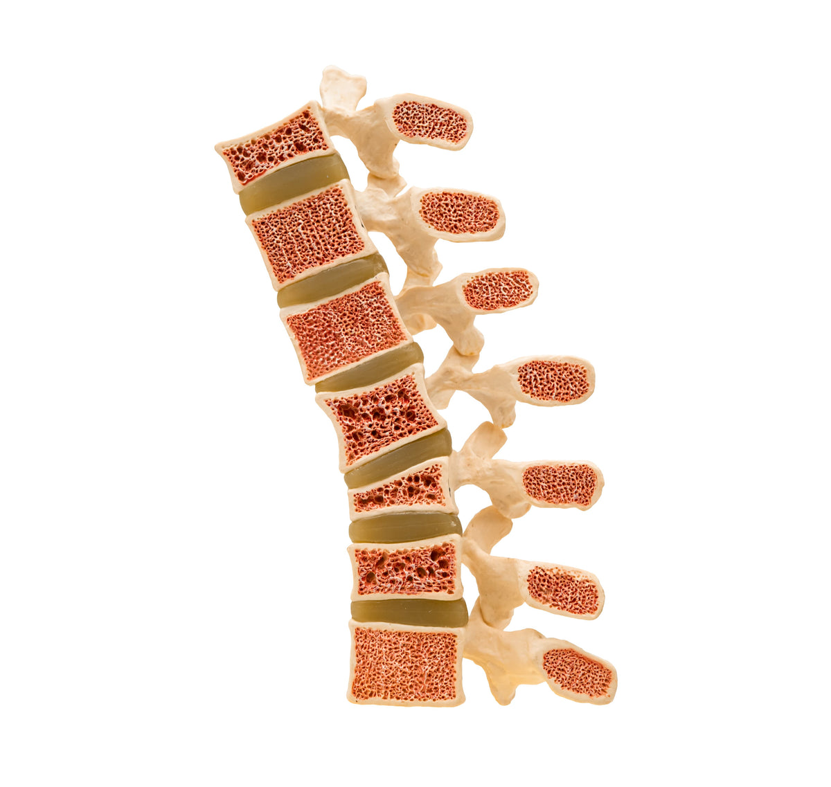 Calcium bildet gemeinsam mit Phosphat die mineralische Grundsubstanz der Knochen.