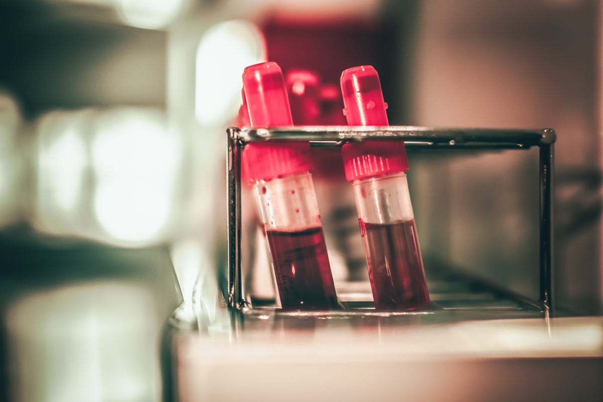 Vitamin B12: Warum gerade Veganer und Ältere aufpassen sollten
